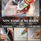 🔥2026 New Arrival: Buy 2 Get 1 Free⚡50K+ SOLD!🏠Household Mold Remover Gel✨
