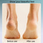 🔥Hot Sale 50% OFF💕Rechargeable Electric Foot Callus Remover