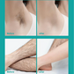 ❤️Buy 2 Get 1 Free🔥Painless Full Body Hair Removal Cream
