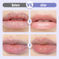 ⚡Buy 1 Get 1 Free⚡Plumping & Anti-Wrinkle Hydrating Lip Serum