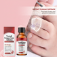 🔥Buy 1 Get 1 Free🔥Nail Repair Essence for Damaged Nails