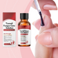 🔥Buy 1 Get 1 Free🔥Nail Repair Essence for Damaged Nails