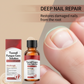 🔥Buy 1 Get 1 Free🔥Nail Repair Essence for Damaged Nails