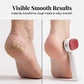 🎉Buy 1 Get 1 Free🦶 Double Sided Stainless Steel Foot Scraper Callus Remover ✨